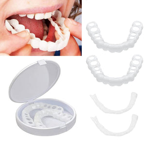 Snap on Smile Veneers - Adjustable Snap on Dentures - Smilo™